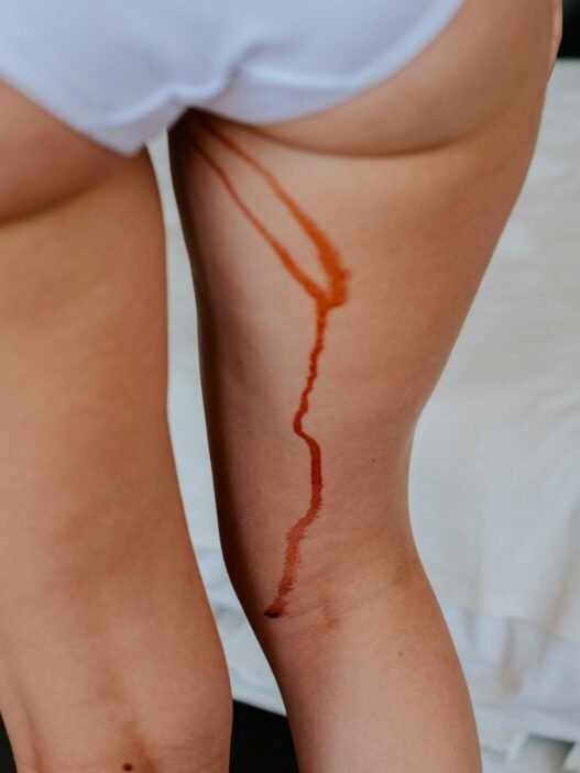 A biological female with menstrual blood dripping down their leg.