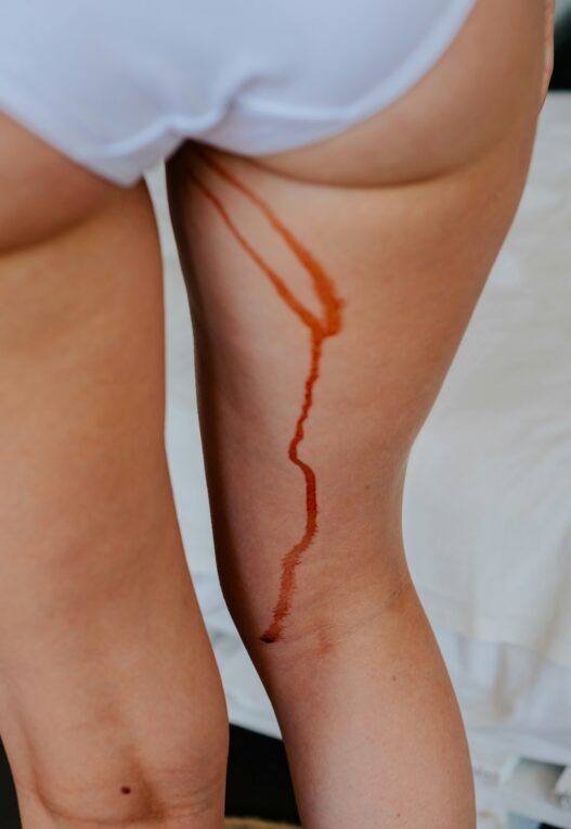 A biological female with menstrual blood dripping down their leg.